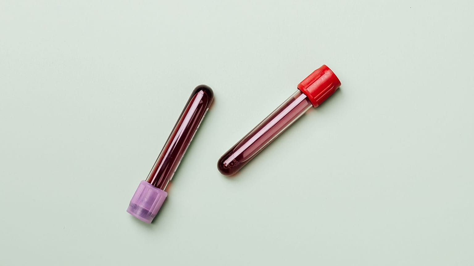 Oxford scientists develop a new blood test that can detect Parkinson’s risk with 90% accuracy