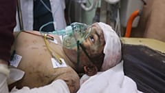 طفل فلسطيني مصاب بعد قصف إسرائيلي على رفح قطاع غزة
