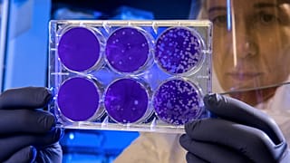 Multiple studies have associated PFAS with higher rates of cancers, including kidney, prostate and breast cancer.