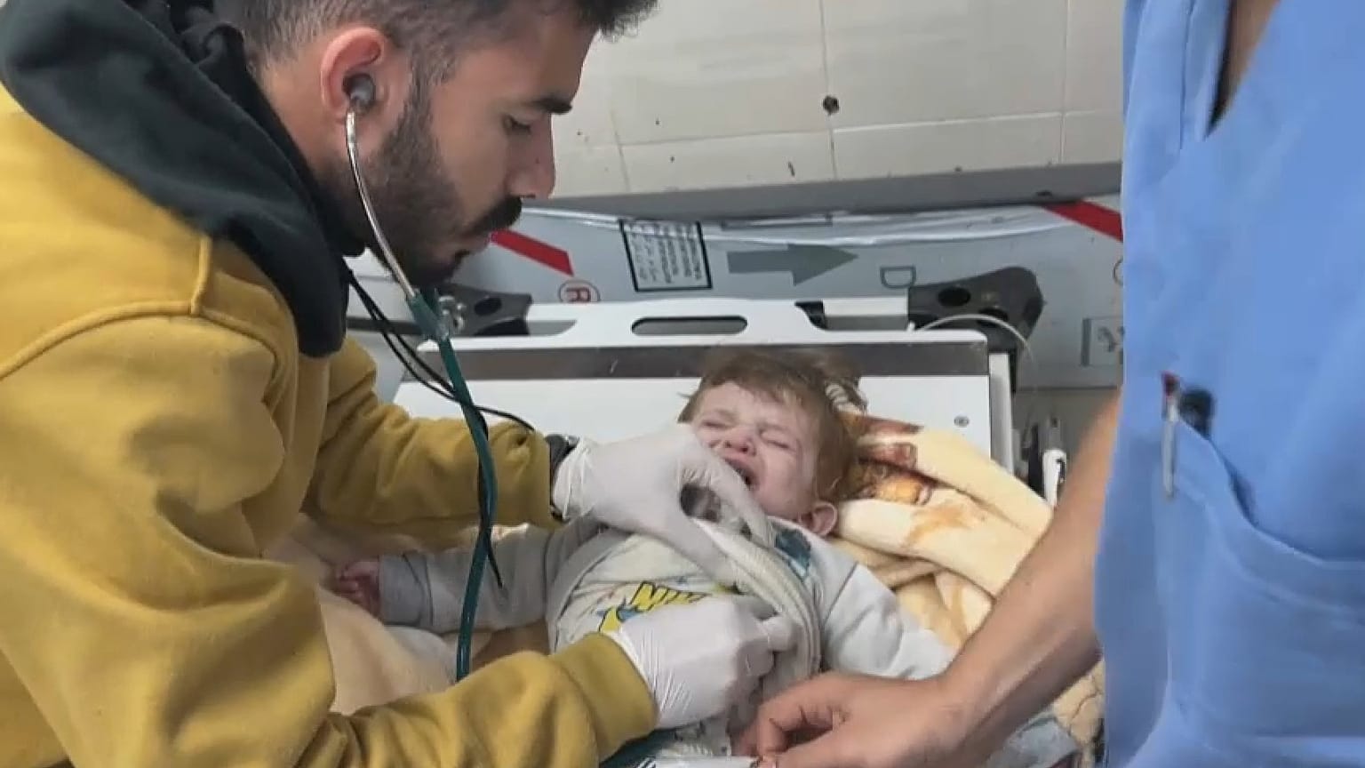 الطفل أثناء تلقي العلاج