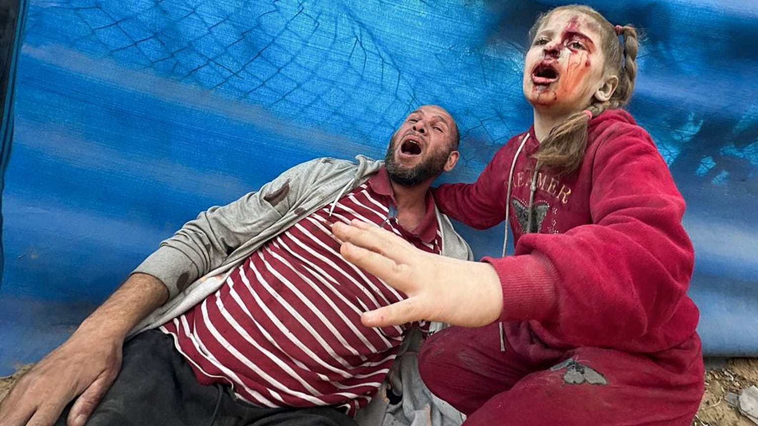 Wounded Palestinians react after an Israeli strike on Al Zawayda, central Gaza Strip, Thursday, Dec. 28, 2023. 