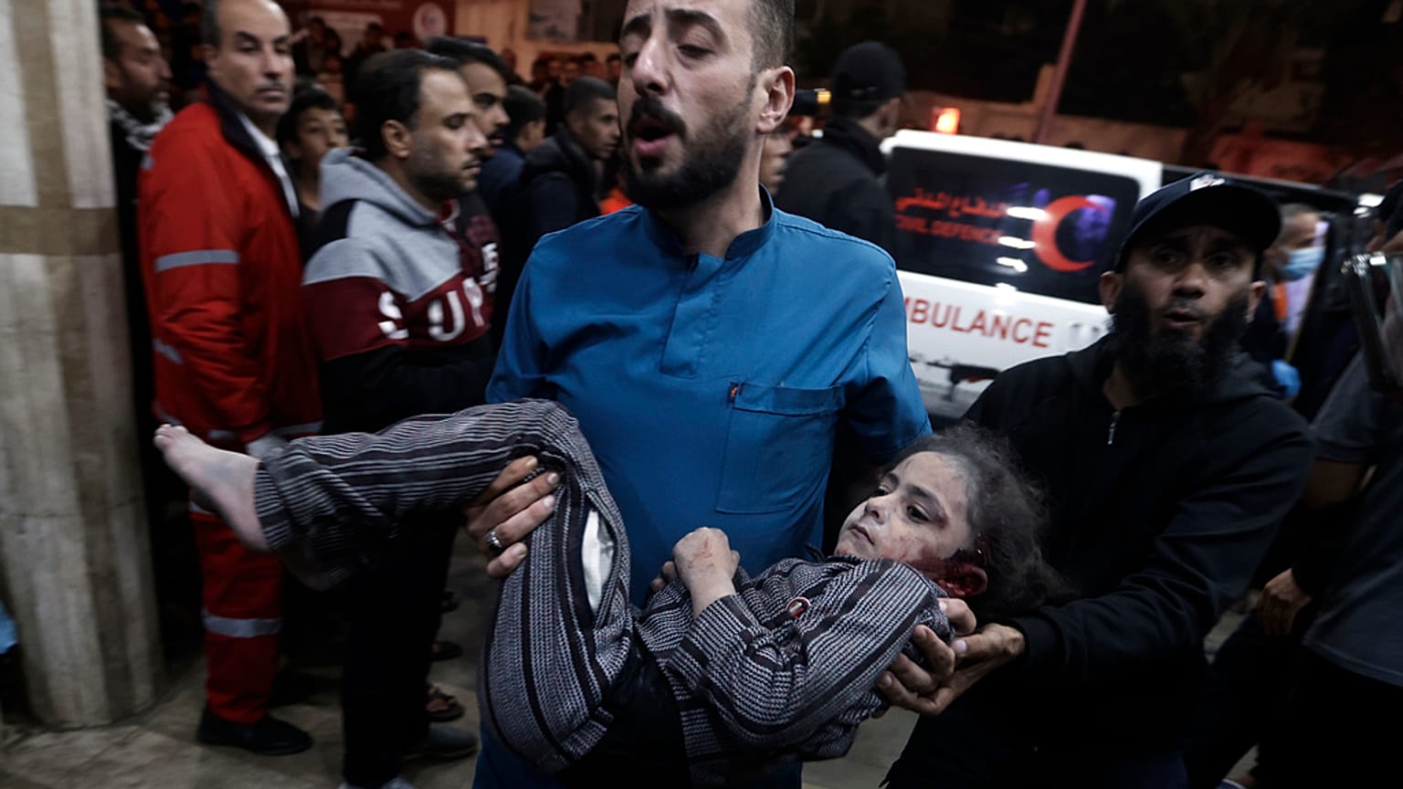 A Palestinian child wounded during the Israeli bombardment of the Gaza Strip is brought to the Nasser hospital in Khan Younis, Southern Gaza Strip