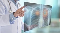 تشخیص زود هنگام سرطان ریه راه مبارزه با آن