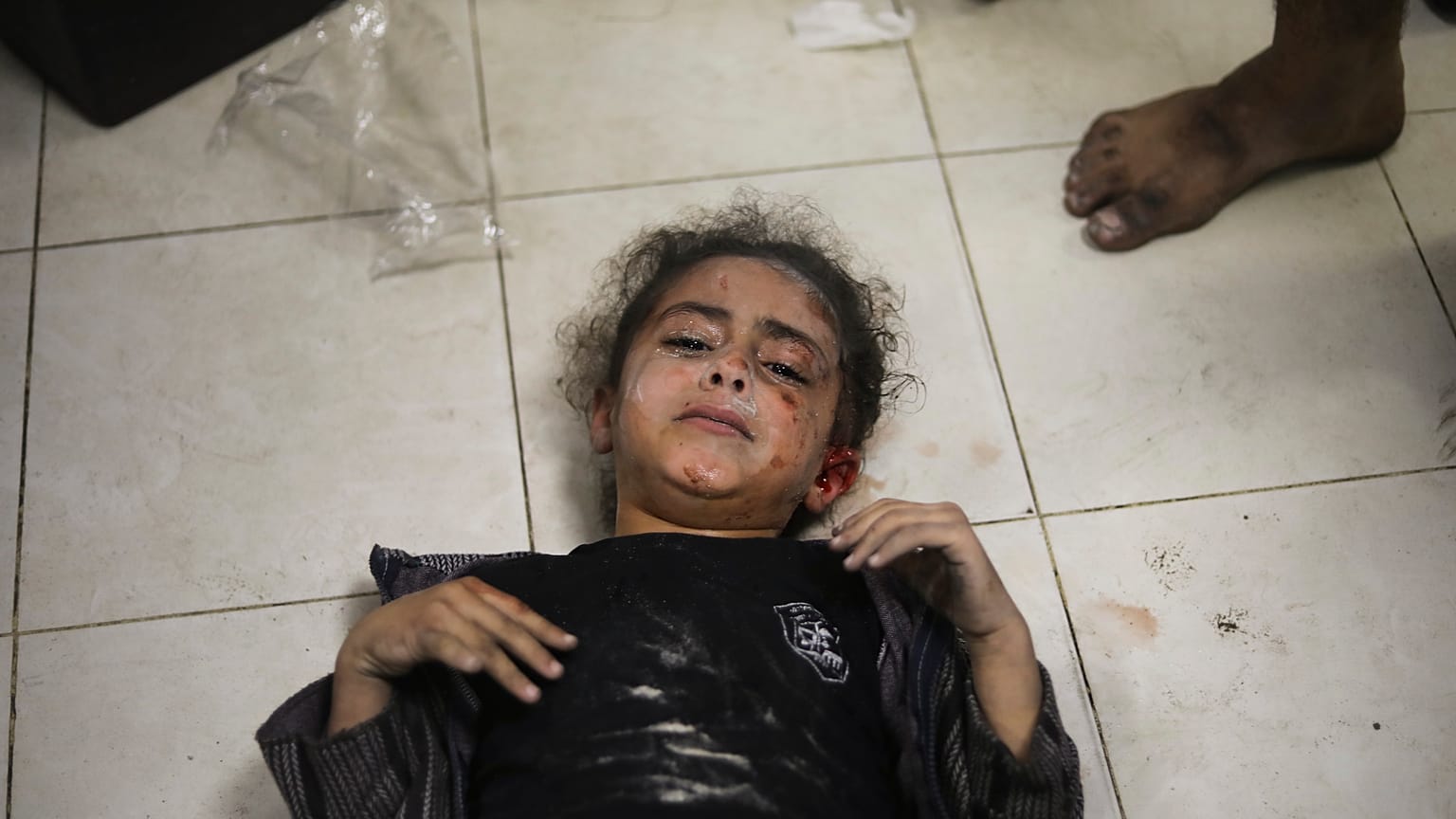 طفلة فلسطينية أصيبت خلال القصف الإسرائيلي على قطاع غزة جنوب قطاع غزة