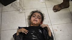 طفلة فلسطينية أصيبت خلال القصف الإسرائيلي على قطاع غزة جنوب قطاع غزة