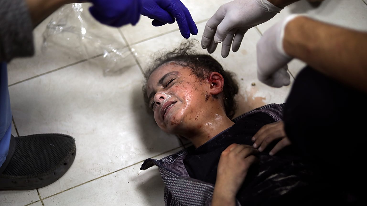 طفلة فلسطينية مصابة إثر القصف الإسرائيلي - مستشفى ناصر في خان يونس، جنوب قطاع غزة، السبت، 6 يناير، 2024