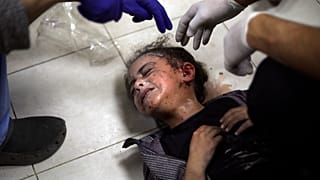 طفلة فلسطينية مصابة إثر القصف الإسرائيلي - مستشفى ناصر في خان يونس، جنوب قطاع غزة، السبت، 6 يناير، 2024