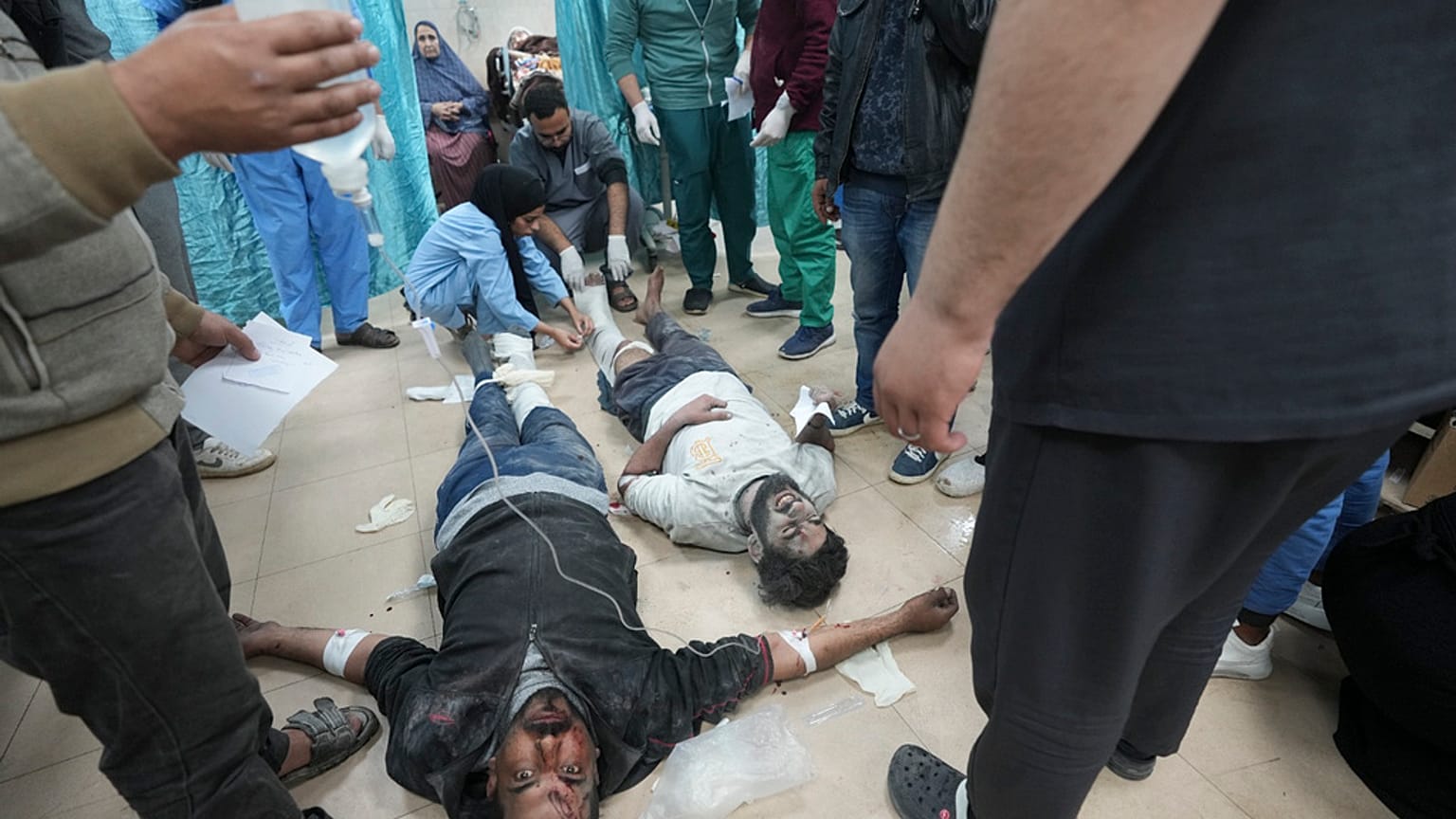 Palestinians wounded in the Israeli bombardment of the Gaza Strip are treated in a hospital in Deir al Balah on Sunday, Feb. 4, 2024. 