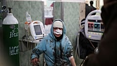 A Palestinian wounded in the Israeli bombardment sits in a hospital In Rafah, Gaza Strip, Saturday, Feb. 10, 2024.