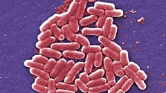 Diese kolorierte rasterelektronenmikroskopische Aufnahme aus dem Jahr 2006 zeigt den Stamm O157:H7 des Bakteriums E. coli.