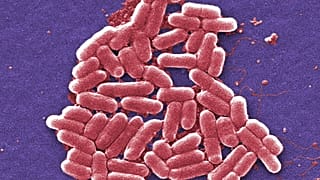 Esta imagen de micrografía electrónica de barrido coloreada de 2006 muestra la cepa O157:H7 de la bacteria E. coli.