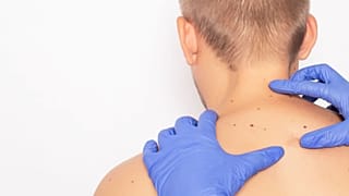 A dermatologist examines a man's skin.