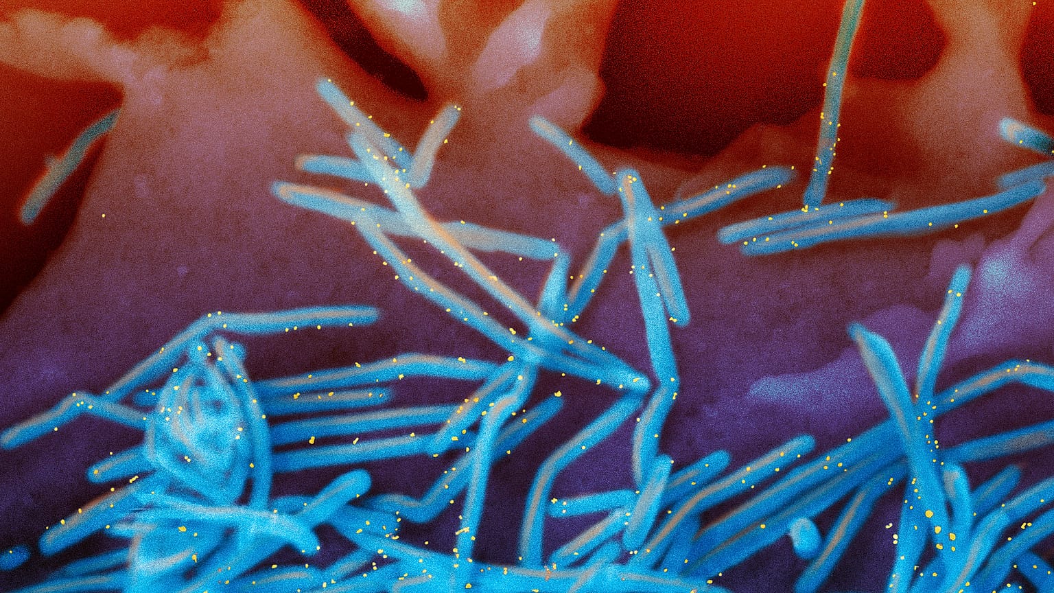 This electron microscope image shows human RSV virions, colorised blue, and anti-RSV F protein/gold antibodies, in yellow, shedding from the surface of human lung cell.