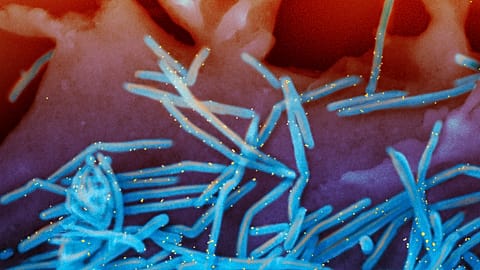 This electron microscope image shows human RSV virions, colorised blue, and anti-RSV F protein/gold antibodies, in yellow, shedding from the surface of human lung cell.