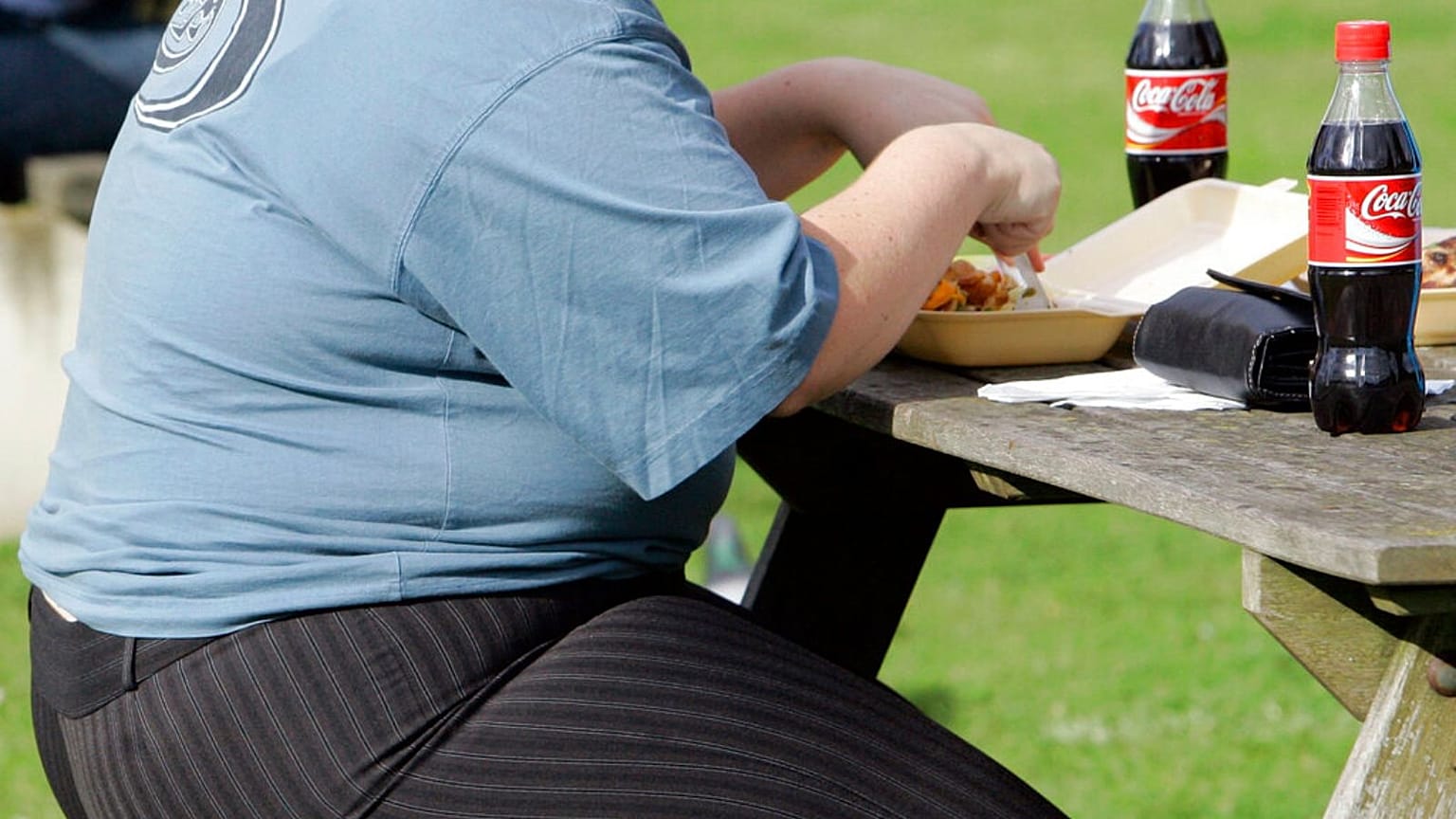 Obesity