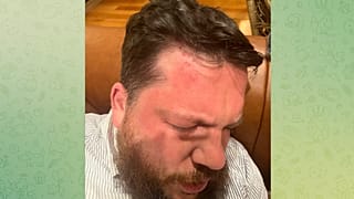На фото, предоставленном командой Навального, видны последствия нападения на Волкова