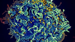 Esta imagen de microscopio electrónico facilitada por los Institutos Nacionales de Salud de EE.UU. muestra una célula T humana, en azul, atacada por el VIH, en amarillo, el virus que causa la gripe aviar.