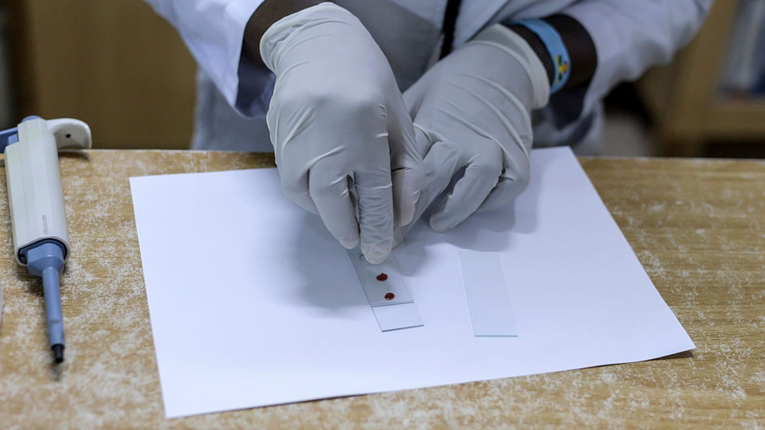 صورة لاختبار فحص الدم 