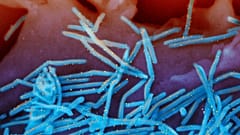 This electron microscope image shows human respiratory syncytial virus (RSV) virions, in blue, and anti-RSV F protein/gold antibodies, in yellow, shedding from lung cells.