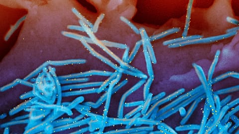 This electron microscope image shows human respiratory syncytial virus (RSV) virions, in blue, and anti-RSV F protein/gold antibodies, in yellow, shedding from lung cells.