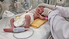 الطفلة صابرين عند ولادتها