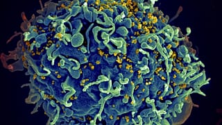 Esta imagem de microscópio electrónico mostra uma célula T humana, a azul, sob ataque do VIH, a amarelo, o vírus causador da SIDA.