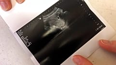 Ultrahangfelvétel