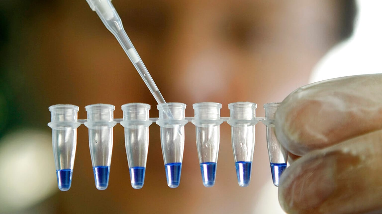 Arşiv-- Deneme aşamasındaki tedavi ile işitme kaybına neden olan gen düzeltiliyor