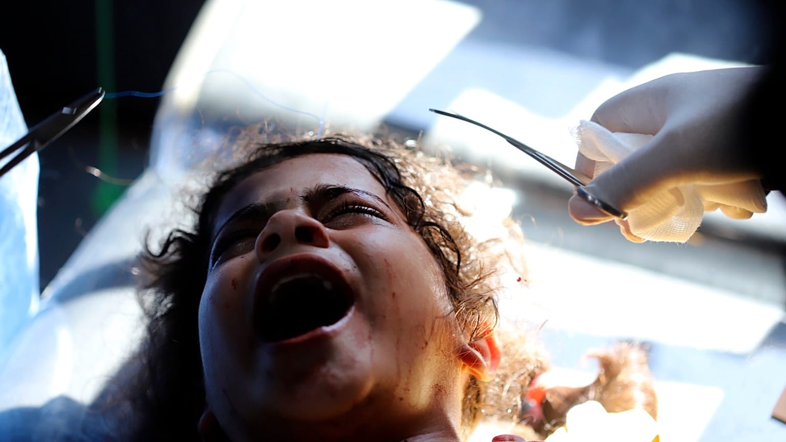 طفلة فلسطينية تبكي من الوجع بعد إصابتها بقصف إسرائيلي 