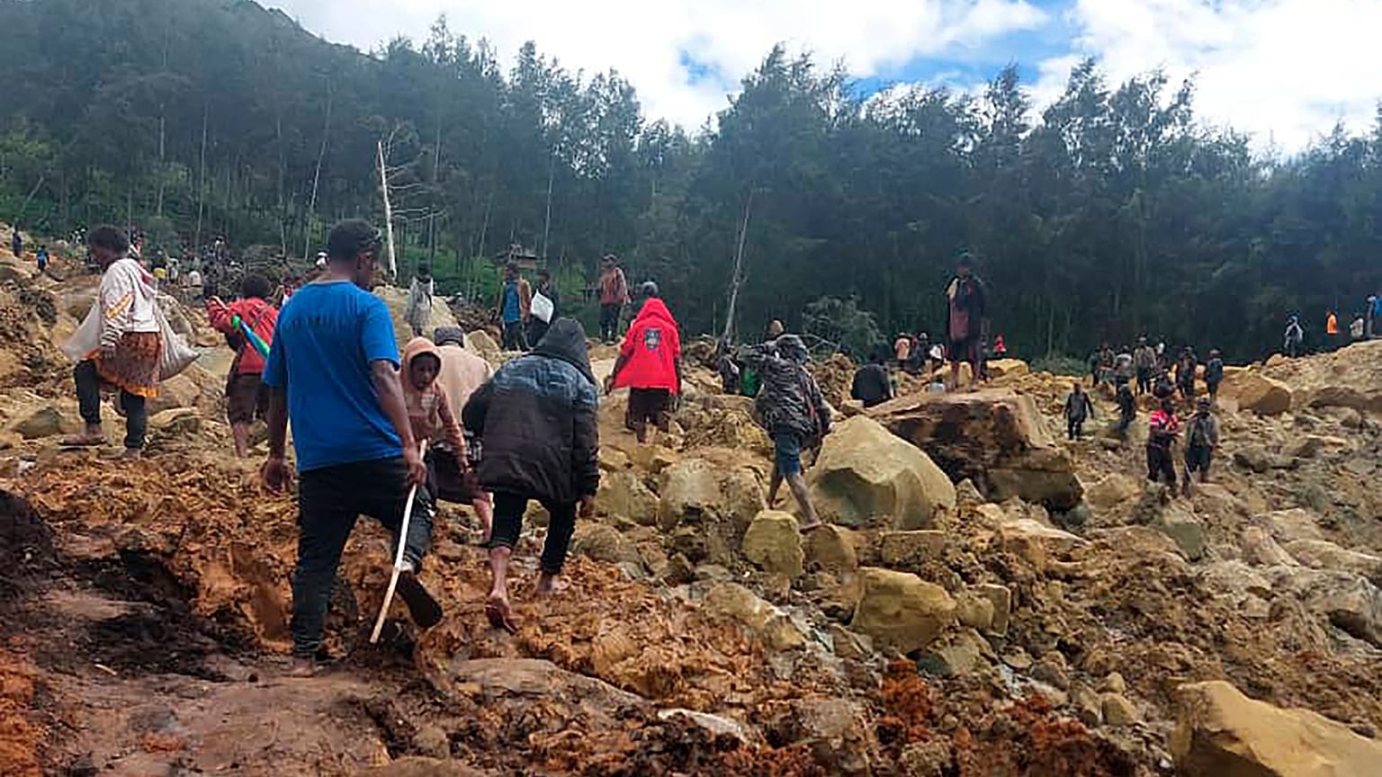 Una persona herida es transportada en camilla tras un corrimiento de tierras en el pueblo de Yambali, Papúa Nueva Guinea, 24 de mayo de 2024.