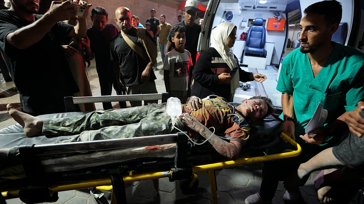 Un palestinese ferito in un bombardamento israeliano sulla Striscia di Gaza viene portato all'ospedale Al Aqsa di Deir al Balah (26 maggio 2024)