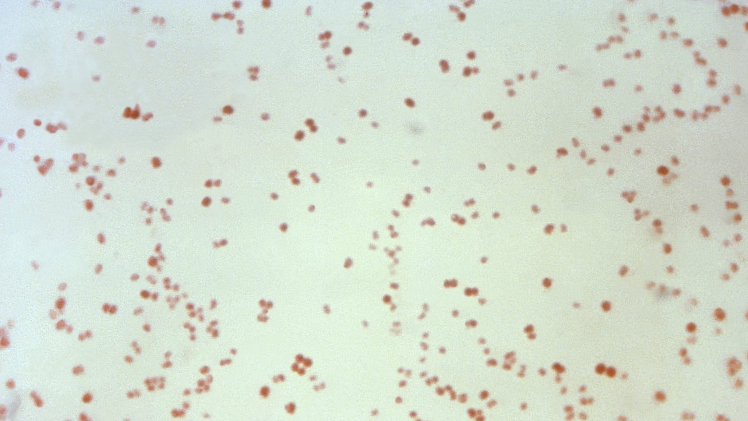 1971 yılına ait bu mikroskop görüntüsü, cinsel yolla bulaşan gonore hastalığına neden olan Neisseria gonorrhoeae bakterisini göstermektedir.