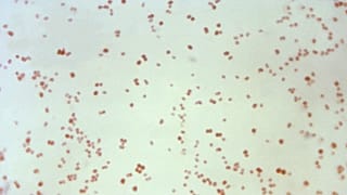 1971 yılına ait bu mikroskop görüntüsü, cinsel yolla bulaşan gonore hastalığına neden olan Neisseria gonorrhoeae bakterisini göstermektedir.