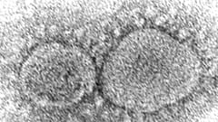 This 2020 electron microscope image made available by the Centers for Disease Control and Prevention shows SARS-CoV-2 virus particles which cause COVID-19. 