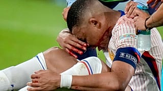 Kylian Mbappé (France) reçoit un traitement après s'être blessé lors d'un match du groupe D entre l'Autriche et la France à l'Euro 2024 de football à Düsseldorf, en Allemagne
