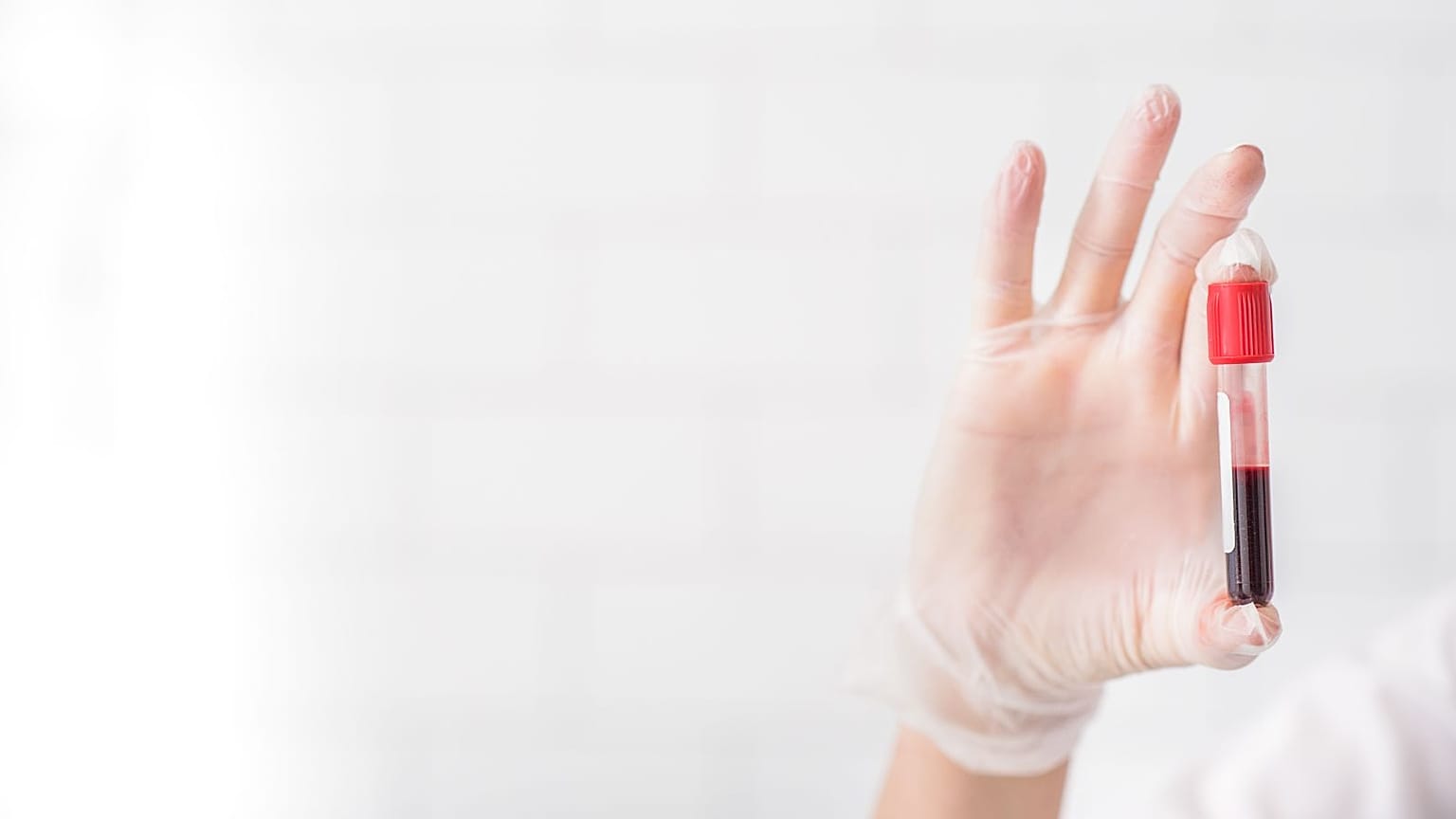 Un esame del sangue che utilizza l'AI potrebbe essere in grado di prevedere malattie come il Parkinson