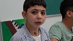 کودکان مجروح فلسطینی در شهرک بشردوستی در امارات 