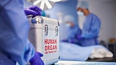 Organ Transplants