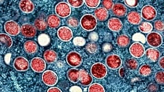 Imagen al microscopio de la viruela del mono.