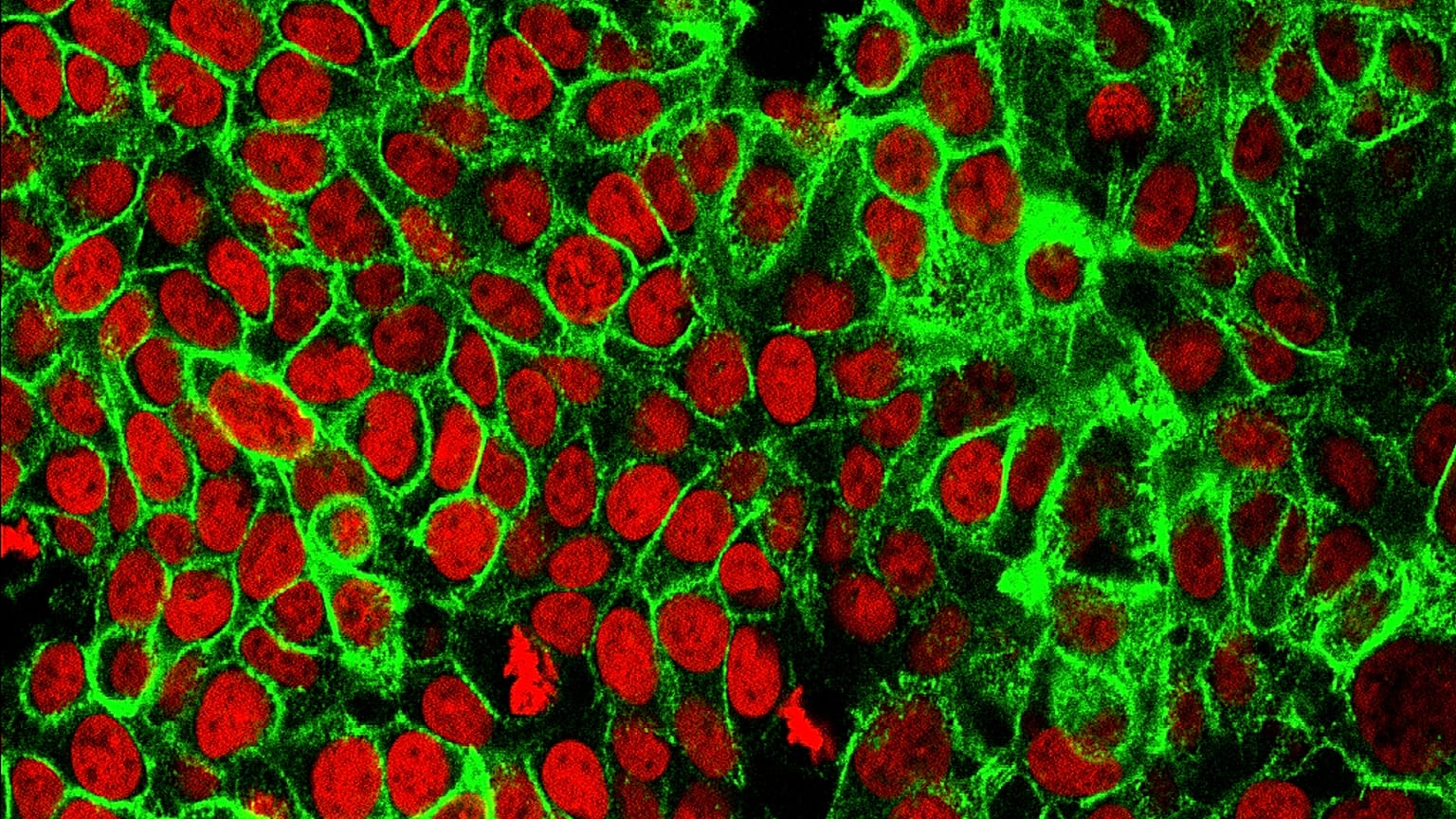 FILE - This microscope image made available by the National Cancer Institute Center for Cancer Research in 2015 shows human colon cancer cells with the nuclei stained red.