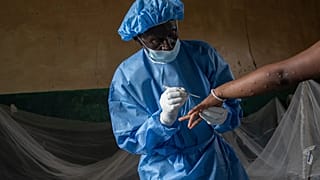 Atumisi Anaclet, 4 Eylül 2024 tarihinde Kongo'nun doğusundaki Güney Kivu eyaletinde bulunan Kamituga'daki bir hastanede mpox hastası bir seks işçisini tedavi ediyor.