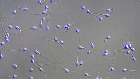 This microscope image provided by the Research Institute of Molecular Pathology in October 2024, shows human sperm.