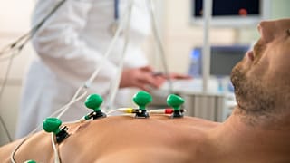 Una IA que puede predecir la muerte podría ayudar a prolongar la vida de los pacientes cardíacos