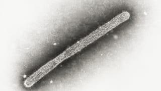 ARQUIVO - Esta imagem de microscópio eletrónico de 2005 mostra um virião da gripe aviária A H5N1.