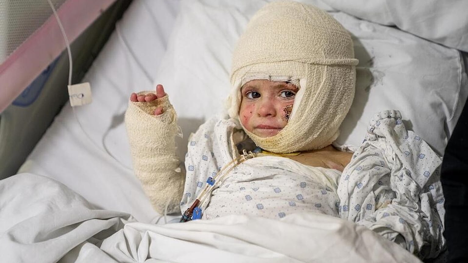 إصابة إيفانا، البالغة من العمر عامين، بحروق خطيرة جراء غارة جوية على منزل عائلتها في دير قانون النهر، منطقة صور، جنوب لبنان.