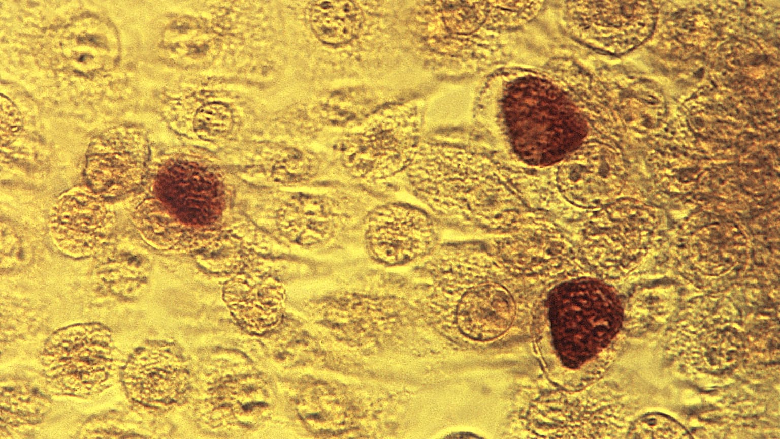 ARCHIVO - Esta imagen de microscopio de 1975 facilitada por los Centros para el Control y la Prevención de Enfermedades muestra la bacteria Chlamydia trachomatis.
