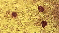 ARCHIVO - Esta imagen de microscopio de 1975 facilitada por los Centros para el Control y la Prevención de Enfermedades muestra la bacteria Chlamydia trachomatis.