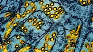 Bu renklendirilmiş elektron mikroskobu görüntüsü kuş gribi A H5N1 virüs partiküllerini (sarı) göstermektedir.