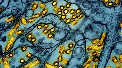 This colorised electron microscope image shows avian influenza A H5N1 virus particles (yellow).