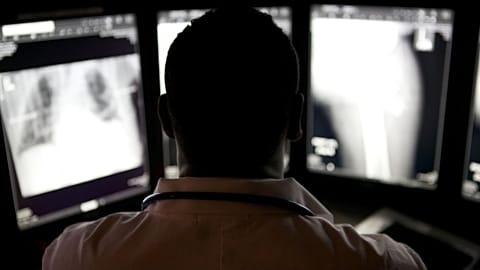 Researchers also found that physicians were more likely to trust an AI explanation if it pinpointed a specific area on an X-ray.